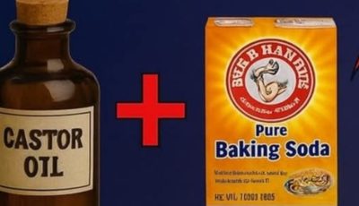 Une recette naturelle efficace : l’huile de ricin et le bicarbonate de soude pour traiter 15 problème