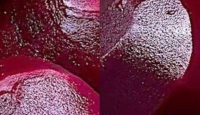 Boost your collagen with these fantastic beetroot recipes to enjoy every evening.
