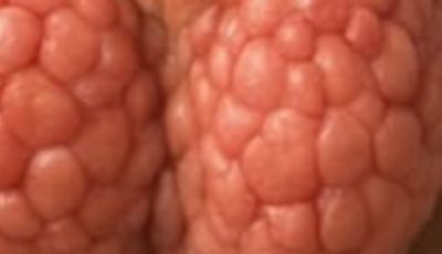 6 Simple Steps to Support Thyroid Health Naturally