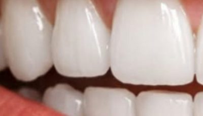 Turmeric and Baking Soda: A Gentle Natural Blend to Support a Cleaner, Brighter Smile