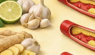 Say Goodbye to Overloaded Arteries with These Powerful Foods