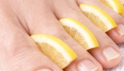 Lemon & Baking Soda Foot Remedy for Discolored or Thick Toenails