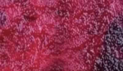 Beetroot for Eye Health: The Powerful Superfood Your Vision Needs