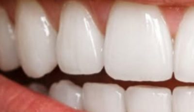 Turmeric and Baking Soda: A Gentle Natural Blend to Support a Cleaner, Brighter Smile