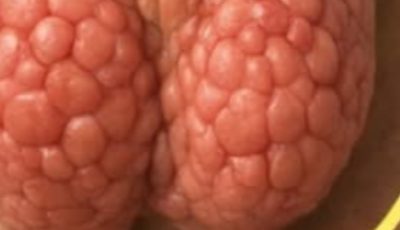 6 Simple Steps to Support Thyroid Health Naturally