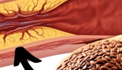 1 Tablespoon a Day: Flaxseed to Prevent Blood Clots, Heart Attacks, and Strokes!