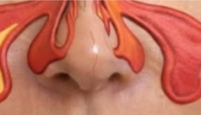 Clove Steam: A Natural Remedy for Nasal Congestion and More