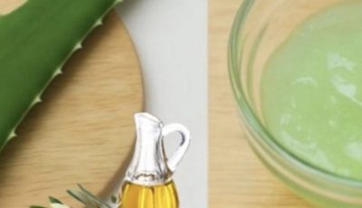 Aloe Vera for Varicose Veins and Tired Legs