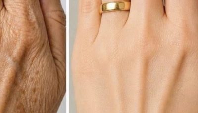 Look at this… these hands looked aged, full of spots…