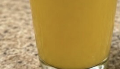 Top 10 Superfoods from Your Kitchen to Quickly Reduce Proteinuria and Support Kidney Health!